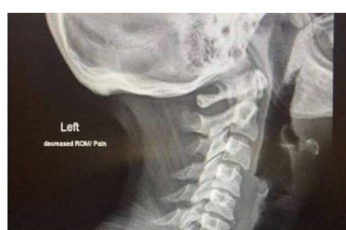 2313-jpg-99191940925000452