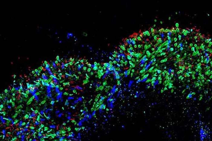 24d56863-64e8-4b34-b4f3-697bc315037c_16x9_1200x676