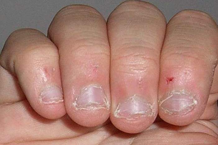 5bd3259895a597f50d8b45f4