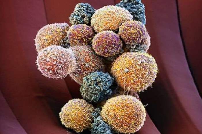 5c3c414895a59783028b45cf