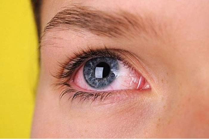 6352194c0dad8a2164c8b72c214c57e7