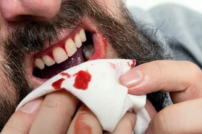 x136967.jpg.pagespeed.ic.YCCpZOJAtA