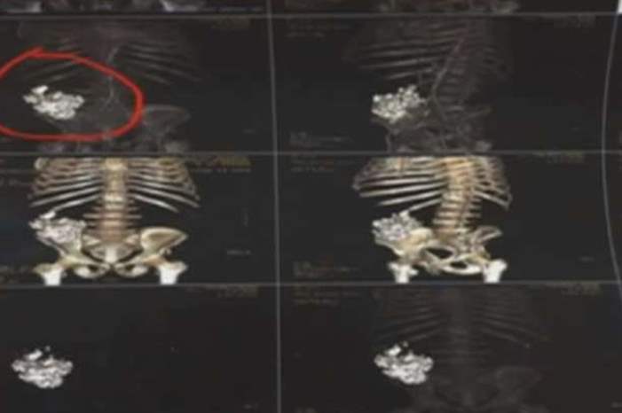 5c66a498d4375075498b461b