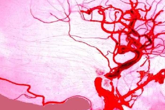 5c8a369c95a597ab338b45c1