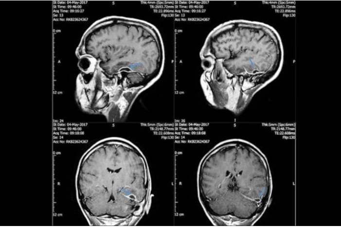 capture-png-24331115751556043