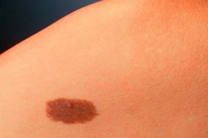 556-jpg-13518272925185913