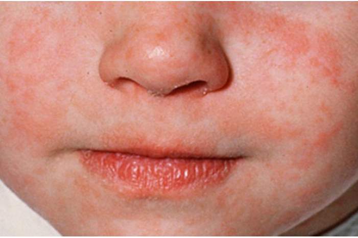 ed88bf3c-6125-4849-afd2-cf9dc07bd215_16x9_1200x676