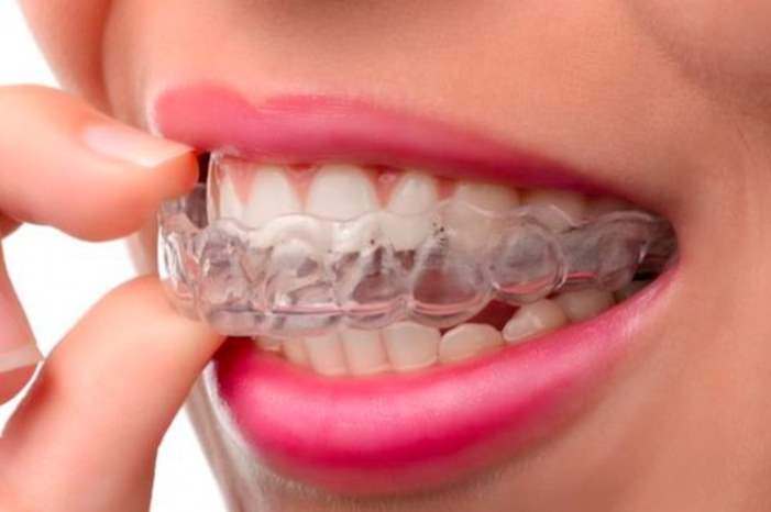 News-P-430448-636870513758368843