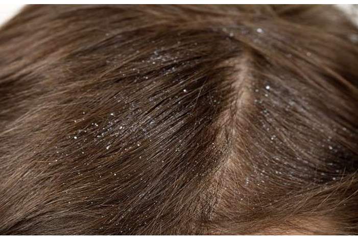 5c7fbdcfd4375026628b45f2