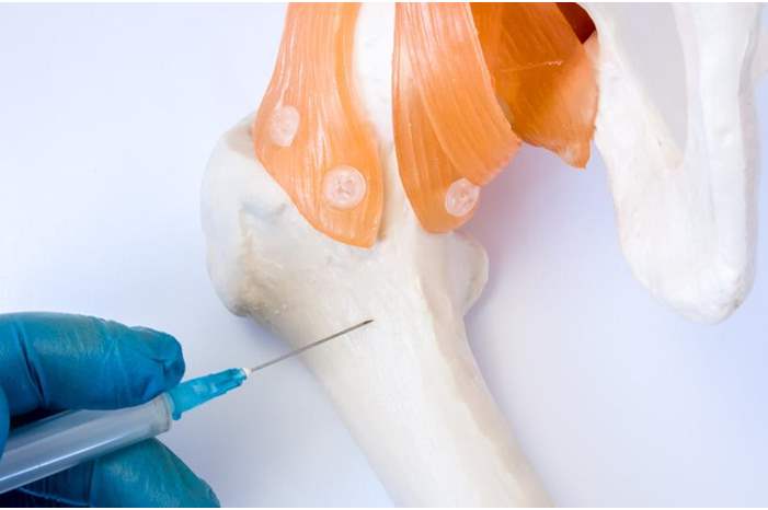 e46dfbe4-c83d-4634-a4c8-2a7a88f001a7_16x9_1200x676