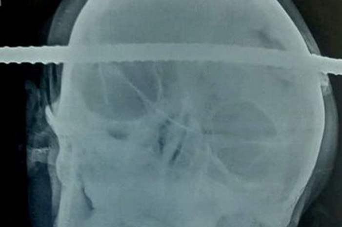 b70965b36f6353e266ccf3db1b32a14f