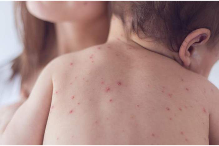 8f669a47-5fea-434b-a332-f0a3820b5f61_16x9_1200x676