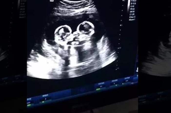 Doc-P-577769-636910098982306236