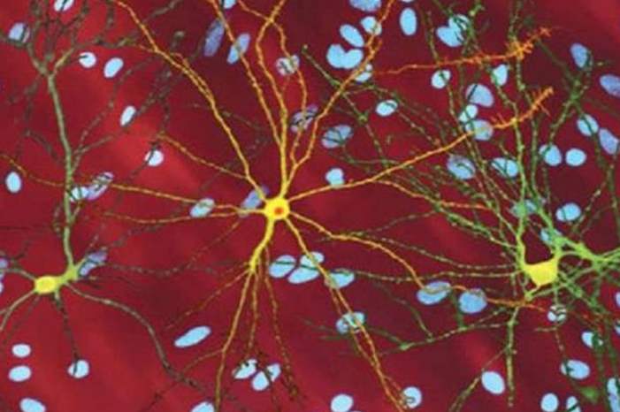 5cb5960895a597b0228b45bd-jpg-54321558008215517