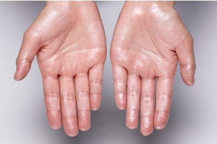 5cbeed1695a5973d3c8b45e2