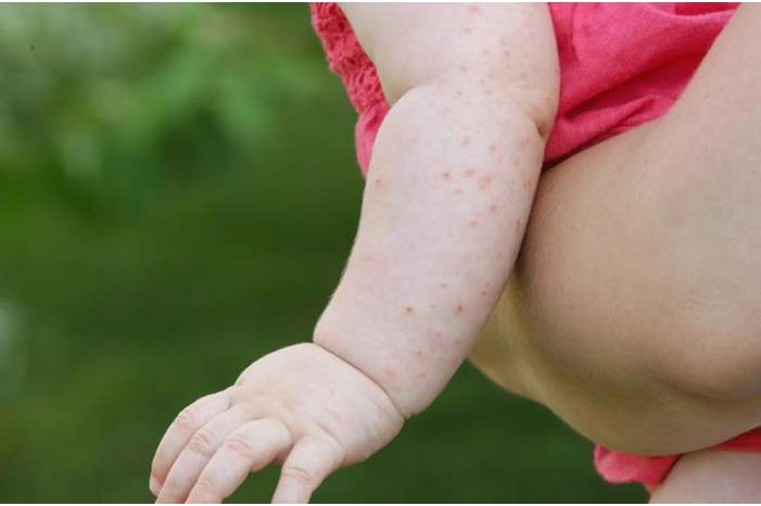 3c2d9ca7-ca43-4764-b43d-5adc60d12fb3_16x9_1200x676