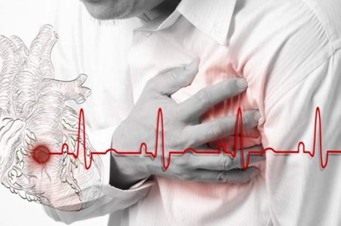 qmvsub3s-jpg-730x470-jpg-6320615511415336-jpg-3510248667065011