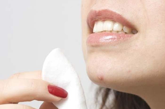 header_image_Article-Main-Fustany-How-Your-Period-Affects-Acne-and-Skin