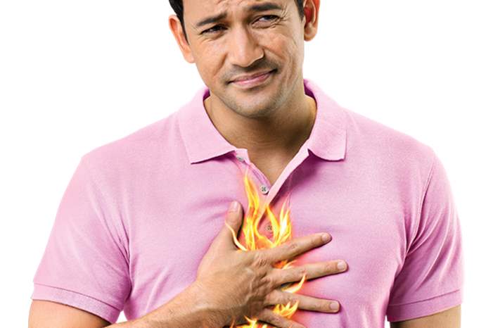 _الكثيرين من حرقة المعدة