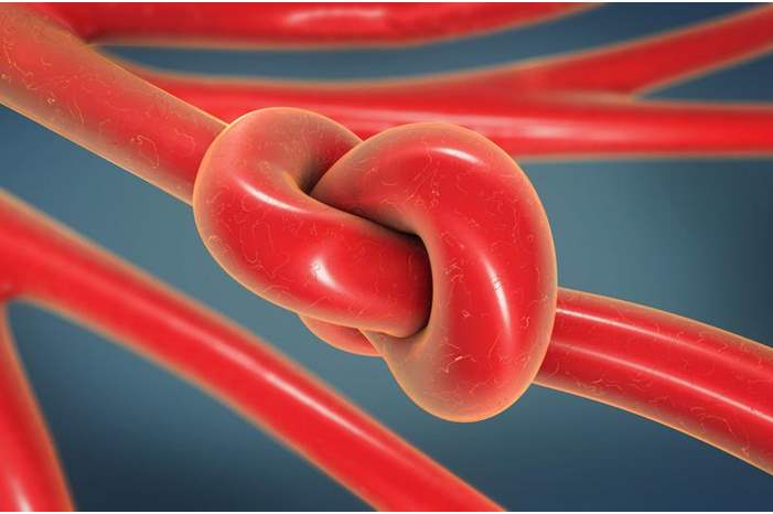 0aff70a7-81ea-4beb-81ce-48924ef79c7f_16x9_1200x676