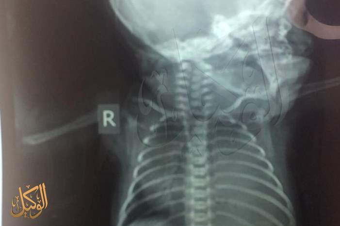 58772317_2241647972587854_2472975085942603776_n