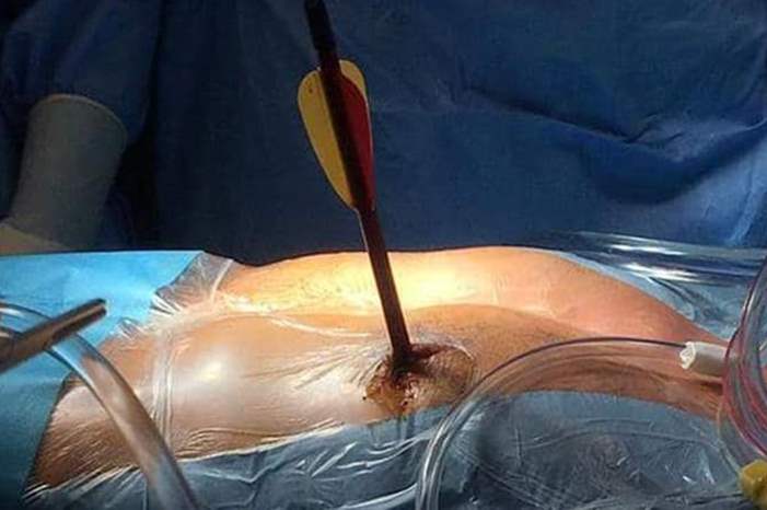 Doc-P-590212-636941945420510663