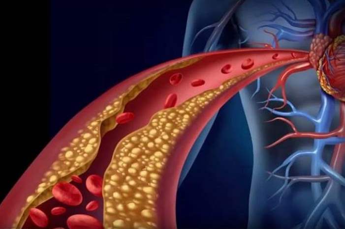 5ce5291cd43750be038b45a2-jpg-81332899785113915