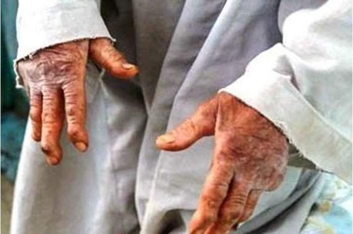 120187184342401590978