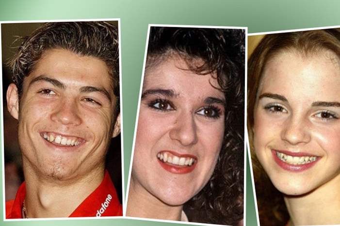 هل-كنت-سترى-ابتسامة-هؤلاء-المشاهير-جذابة-قبل-تجميل-أسنانهم؟-1300x600