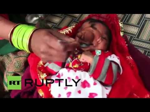 فيديو من الهند.. طفلة تولد بخرطوم فيل وأهلها يفرحون بذلك