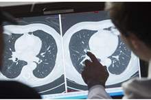 5c39c90195a5977f488b45ae