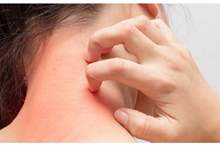 حساسية-نادرة-1300x600