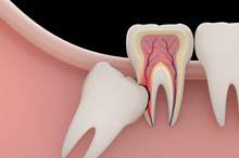 News-P-429979-636868771331484810