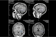 capture-png-24331115751556043