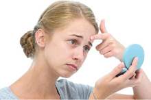 Jerawat pada Wanita dan Cara Mengobatinya