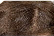 5c7fbdcfd4375026628b45f2