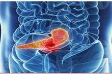 5c7fb49295a597d8588b458d