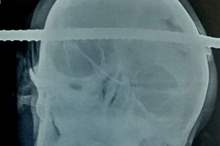 b70965b36f6353e266ccf3db1b32a14f