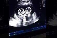 Doc-P-577769-636910098982306236