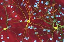 5cb5960895a597b0228b45bd-jpg-54321558008215517