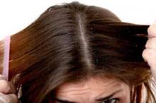 قشرة-الرأس-.-ثقف-نفسك