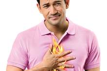 _الكثيرين من حرقة المعدة