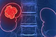 main_image5ce3921429773