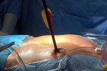 Doc-P-590212-636941945420510663