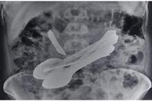 eb4a88ae-dad6-4f59-9b31-a19b4ae3cd8e