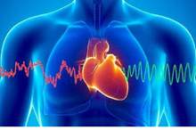 4b8037d408c11c3a92a50afcfc07f45f_M-1500x9999-c